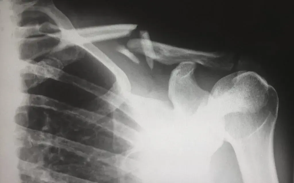 What is the cost of minor injuries when working at heights?